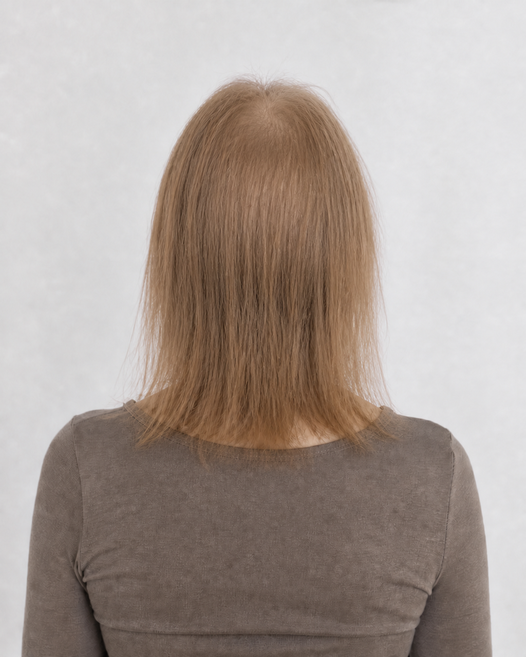 Invisible Tape Weft Light Brown #8 – before met dun haar